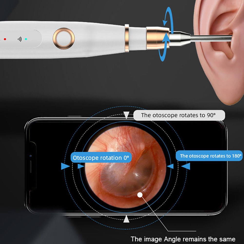 39MM-Wireless-Ear-Cleaning-Borescope-10MP-HD-Digital-Ear-Otoscope-Inspection-Camera-6-LED-Light-1682403